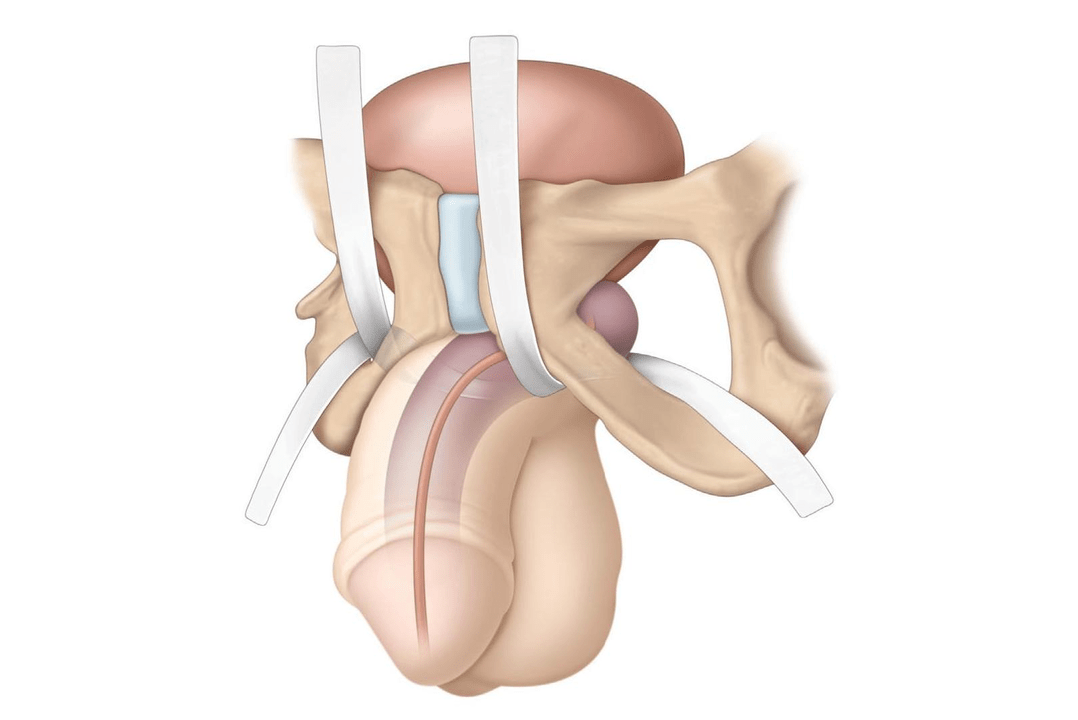 locations investigated for the presence of filler