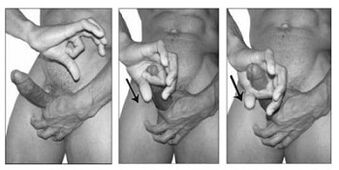 Special exercises for the increase in penis